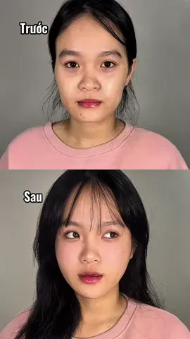 💉 Cân chỉnh full face không chỉ là tiêm filler – đó là nghệ thuật “điêu khắc khuôn mặt”! Chỉ sau 1 buổi tiêm nhẹ, gương mặt: ✨ Hài hòa – thanh thoát ✨ Gò má mềm – cằm thon gọn ✨ Mũi, môi, cằm vào form tự nhiên