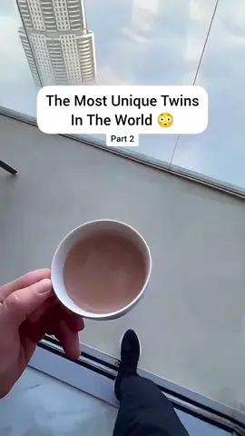 The Most Unique Twins In The World 😳#fyp #twins #interesting 