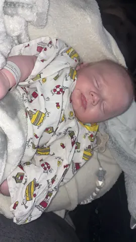 05/11/2025 🦶🏻TENOTOMY OPERATION🦶🏻clubfoot awareness 💫 Cruz had his tenotomy operation today at 10 weeks old after 7 weeks of casting! The first bit of the video is to show 4 days before his tenotomy  his cast slipped off in my hand 😢 no specialists were in over the weekend so he was casted again on Monday I was worried this might set him back but luckily it didn’t. He was casted for a day and I had to take them off myself in the bath at home last night ,which was quite hard trying to cut through them whilst he’s crying 🥲 we had to be at the hospital at 7am this morning where he was put into one of the little cot beds and was observed for a while. The surgeons then came down and marked his feet and we walked down to the theatre. We had lots of cuddles before they took him off to give him his local anaesthetic I was in tears it’s not a nice feeling leaving your baby to go to theatre🥲which felt like forever but actually was quite quick he was out they said he screamed and cried all the way through and had to stop halfway to comfort him 😭 he was still crying when we went into recovery with him but as soon as he heard mummy and daddy he fell asleep in my arms , I’m so proud of you my brave boy ❤️❤️❤️ tenotomy surgery is to correct his feet and bring them upwards lengthen the tendons , his left foot has completely corrected but his right foot not so good so we will be having a review and will get the news whether he will have a second tenotomy ❤️ another step closer to fixing them gorgeous little feet 👣  #clubfoot #clubfootjourney #clubfootcutie #fyp #clubfootbaby 