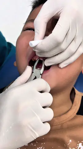 #nhakhoaduyngoc #nhorangsua #nhorangchobe 