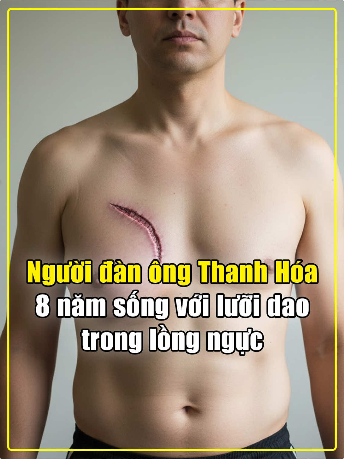 Người đàn ông Thanh Hoá 8 năm sống với lưỡi d** trong lồng ngực #khampha #khoahoc #fyp #LearnOnTikTok #discovery 