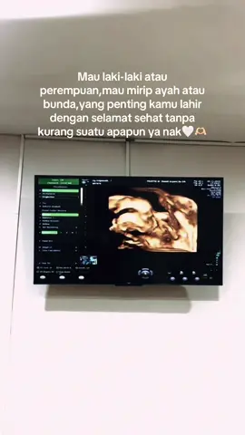 #usg4d #calonanakmama #usg 