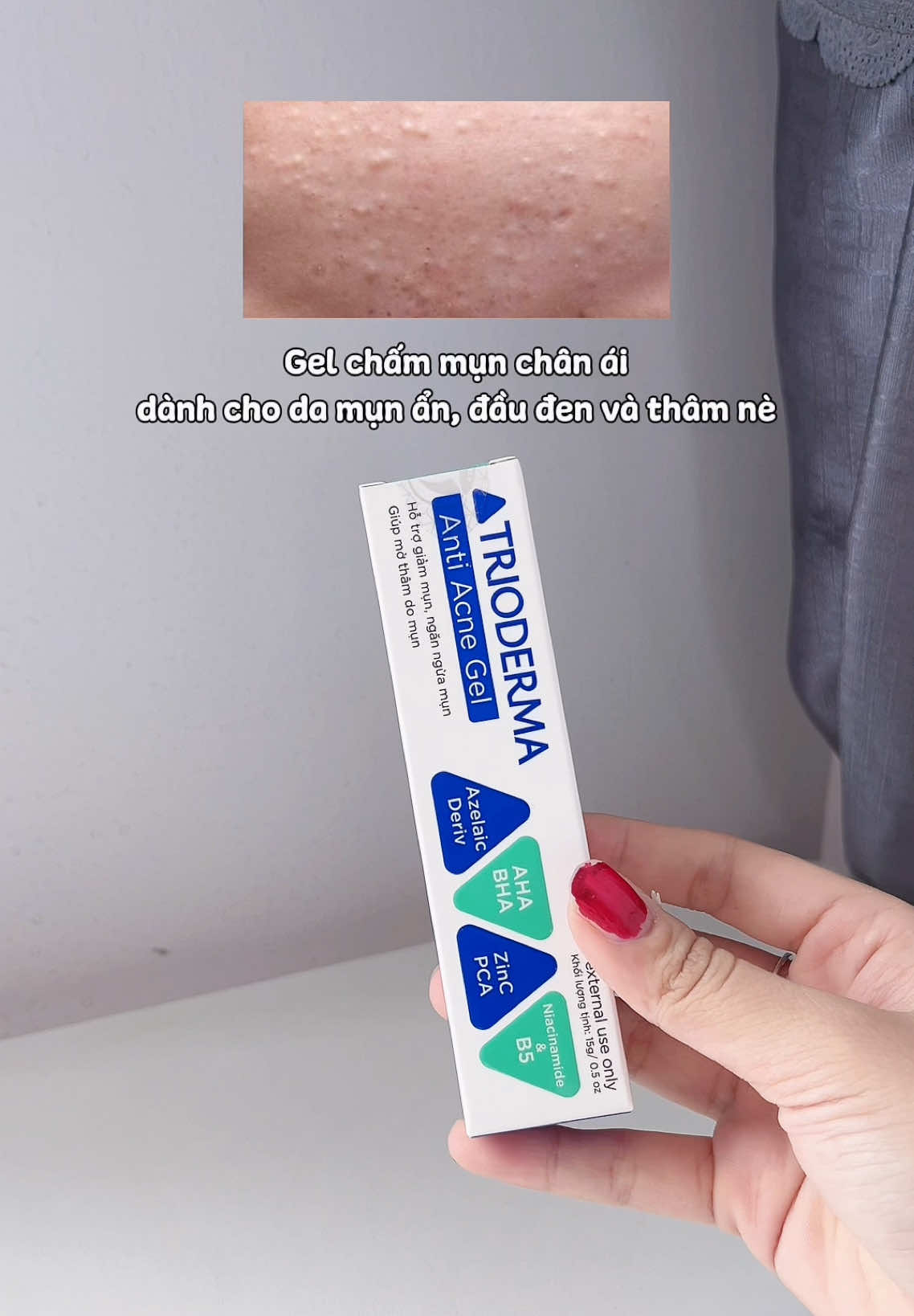 Gel chấm mụn Trioderma cho da mụn đầu đen, mụn ẩn, dày sừng và thâm do mụn #trioderma #gelchammun #kemmun #kemchammun #gelchammuntrioderma 