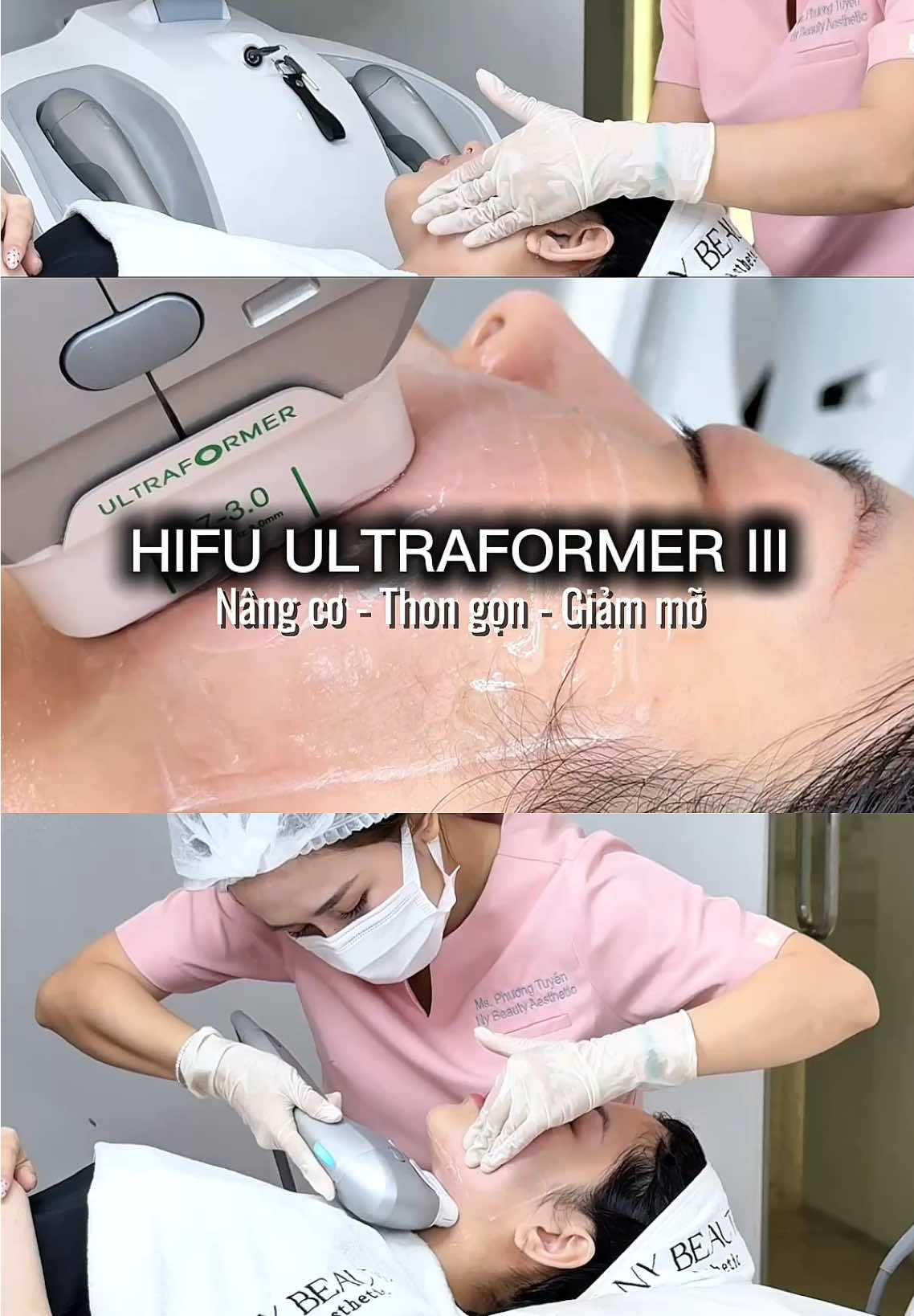 Hifu 1 lần để thấy mình trong một phiên bản nâng cấp hơn của mình nhé khách ơii #viral #trending #hifu #nybeauty #spathuduc 