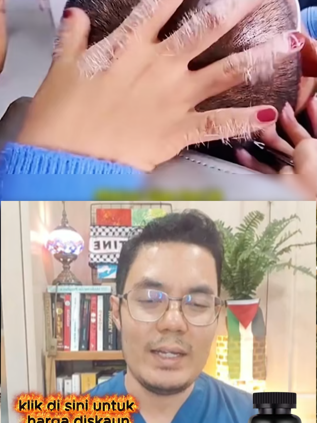 Rahsia rambut tebal dan sihat — dengan pil herba ginseng hitam setiap hari!