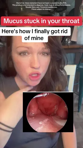 Mucus stuck in your throat? #guthealthmatters #guthealth #mucus #phlegm #guthealthtiktok 