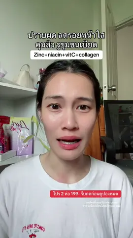 #ซิงค์เมดิต้า #ซิงค์เมดิต้าzinc #ซิงค์พลัส #เฟินฟุ้ยป้ายยา 