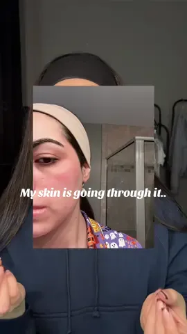Your girls skin went through it!! #skin #skincare #dryskin #damagedskin #skinproblems #skinproducts #fyp 