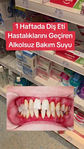 #tik_tok #VoiceEffects #videoviral #goviral 