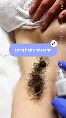 Waxing long hair in the underarm area using blue hard wax formula from @Starpil Wax  If you want to try this amazing formula head to my profile 🔗  and use code ANASTASIA20 at check out to save some 💸 #satisfying #waxingtiktok #estheticianlife #waxingspecialist #estheticiantiktok 