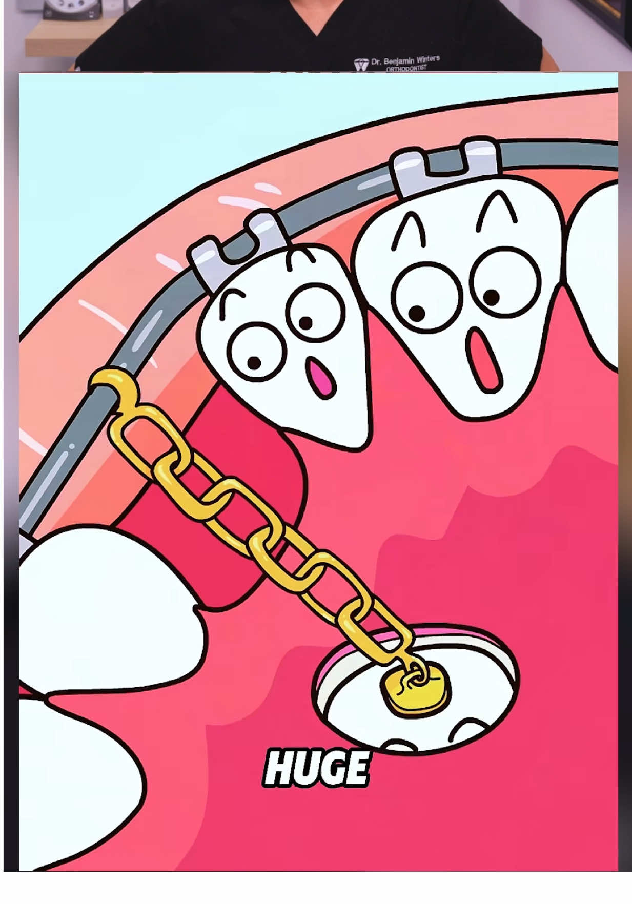 These Dental Videos Are Getting CREEPY! 😭🦷 #teeth #braces #dentist 