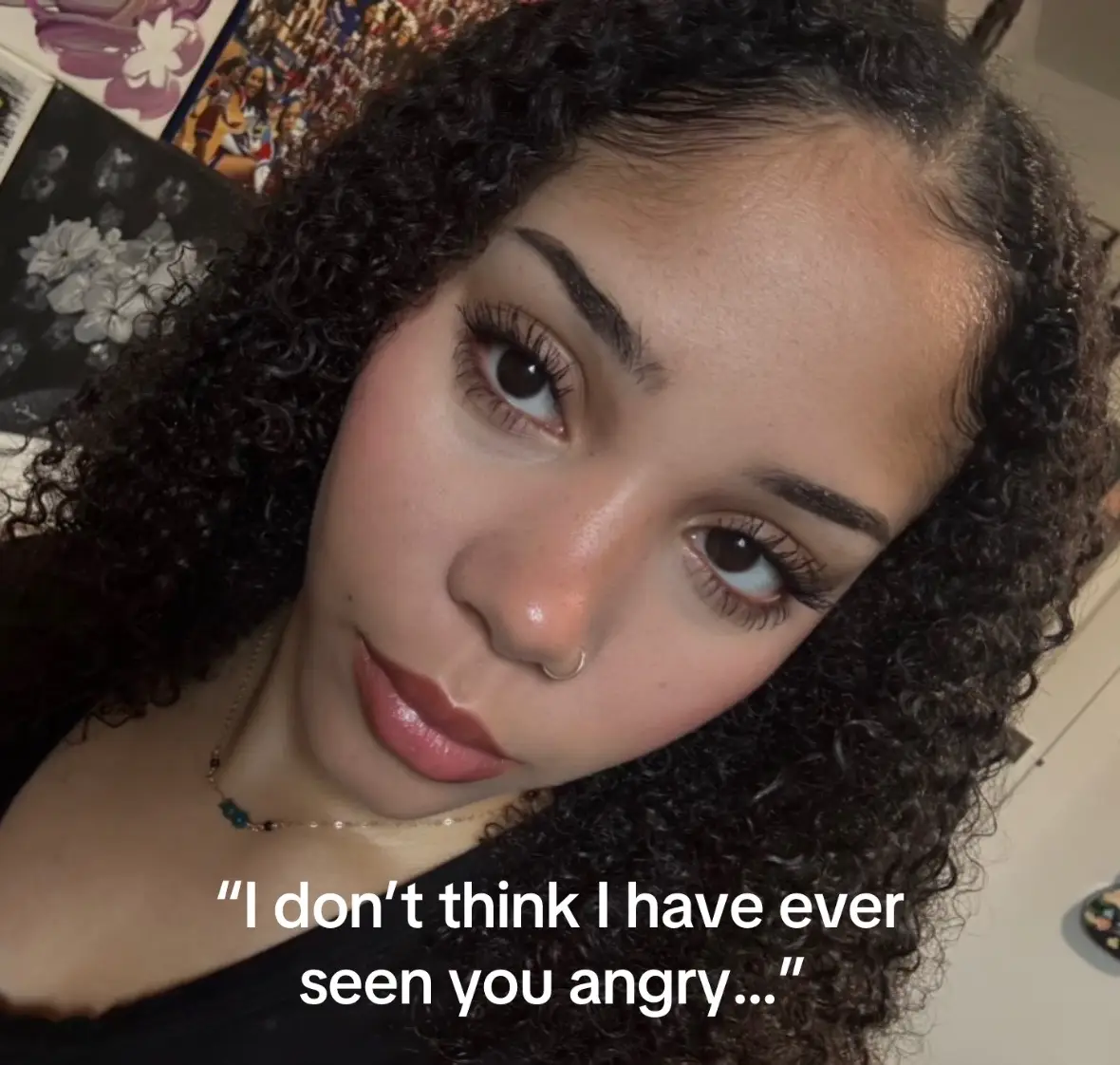 acne tore down my confidence so much 