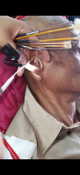 Que dor 🫣... #foryou #satisfacao #ouvidosujo 