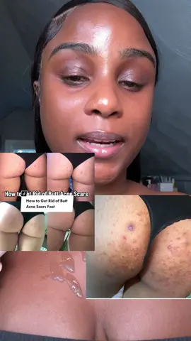 This one is gonna get the body right!  #medicubeskincare #koreanskincare #tiktokshopblackfriday #bodyexfoliation #exfoliation 