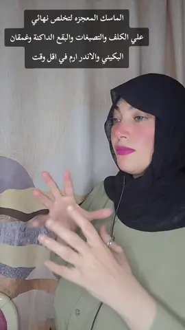 الماسك المعجزه لتخلص نهائي  علي الكلف والتصبغات والبقع الداكنة وغمقان البكيني والاندر ارم في اقل وقت #تفتيح #البكيني #تفتيح_المناطق_الداكنة #كلف #تصبغات 