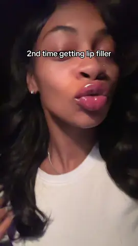 #lipfiller #fypシ゚viral 