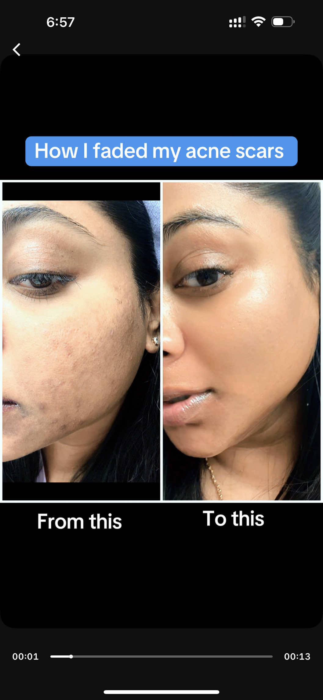 ✨7 days of using Skin1004 Tone Brightening Ampoule and the results are absolutely divine! 🌸 Dark spots? Fading. Acne scars? So much smoother. That glow? Unreal. 💫 @SKIN1004 US #GoViralWithSKIN1004Challenge #SKIN1004White #Blackfriday			#skin1004  #TikTokMadeMeBuyIt    			