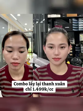 “𝗧𝗶𝗲̂̀𝗻 𝗰𝗼́ 𝘁𝗵𝗲̂̉ 𝗸𝗶𝗲̂́𝗺 𝗹𝗮̣𝗶. 𝗡𝗵𝘂̛𝗻𝗴 𝘁𝗵𝗮𝗻𝗵 𝘅𝘂𝐚̂𝗻 𝗰𝗵𝗶̉ 𝗰𝗼́ 𝟭 𝗹𝗮̂̀𝗻 𝘁𝗿𝗼𝗻𝗴 đ𝗼̛̀𝗶” Xinh đẹp thì mới có nhiều quà nha các nàng ♥️ ⛔⛔⛔Đ𝗲̂̉ 𝘁𝗮̂́𝘁 𝗰𝗮̉ 𝗰𝗮́𝗰 𝗰𝗵𝗶̣ 𝗲𝗺 𝗰𝗼́ 𝘁𝗵𝗲̂̉ 𝘁𝗿𝗮̉𝗶 𝗻𝗴𝗵𝗶𝗲̣̂𝗺 𝗱𝗶̣𝗰𝗵 𝘃𝘂̣ 𝘁𝗶𝗲̂𝗺 𝗳𝗶𝗹𝗹𝗲𝗿 𝗯𝗲̂𝗻 𝗲𝗺, nên Hà 𝘀𝗮𝗹𝗲 40% 𝘁𝗮̂́𝘁 𝗰𝗮̉ 𝗰𝗮́𝗰 𝗱𝗶̣𝗰𝗵 𝘃𝘂̣ 𝗯𝗲̂𝗻 𝗲𝗺 𝗮̣…     ❌HỖ TRỢ LÀM ĐẸP TẠI NHÀ, CÁC TỈNH THÀNH KHÔNG PHÁT SINH CHI PHÍ ! SĐT/ZALO:0982667057  #tiêmfullface #cânchinhfullface #fillier #lamdep 