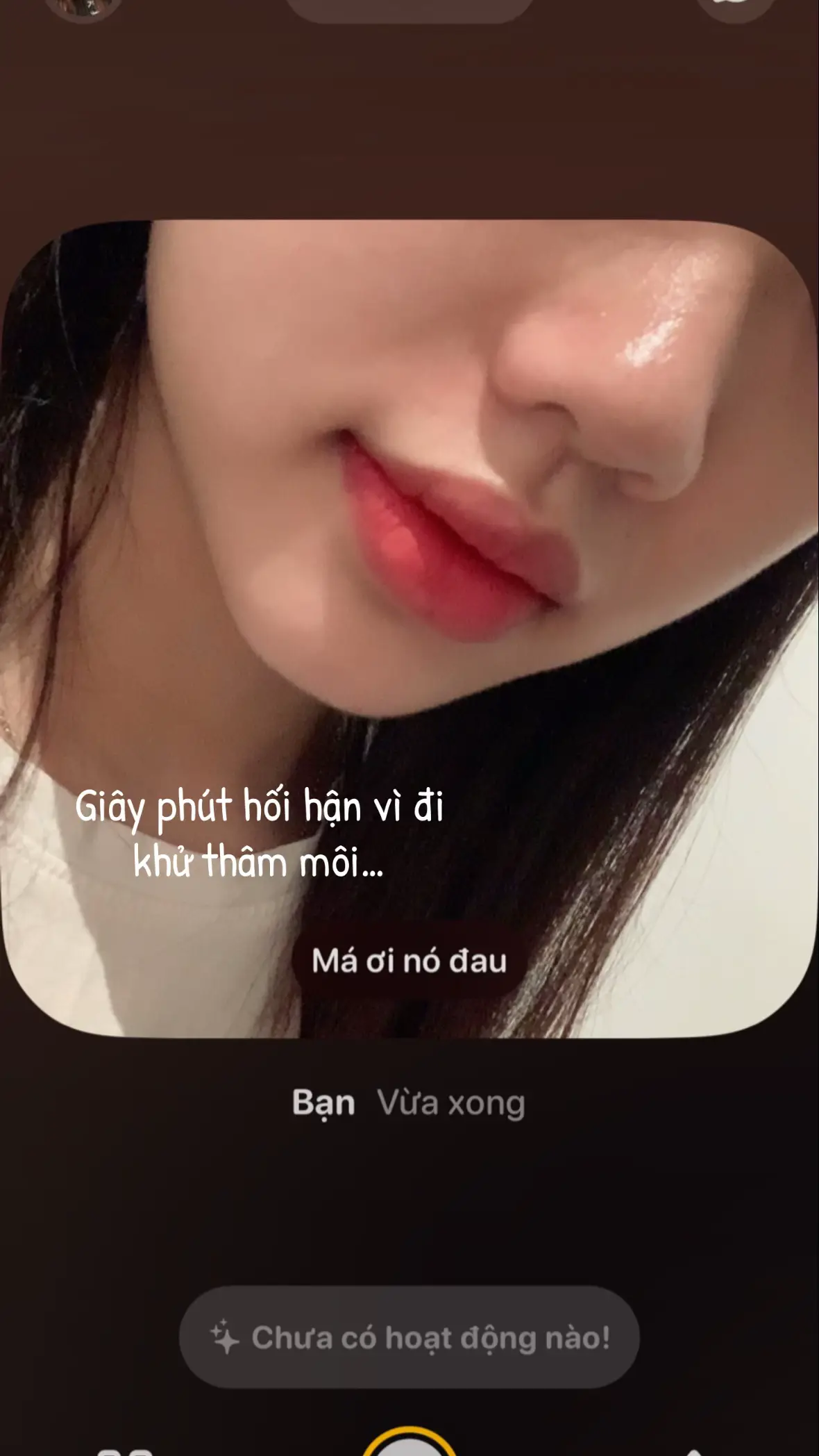 Ai đang phân vân không biết có nên khử thâm môi hay không thì xem hết hình nhé #khuthammoi #xuhuong 