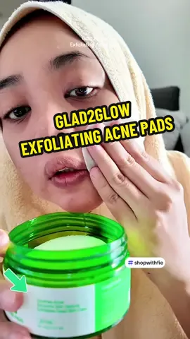 Glad2Glow Exfoliating Acne Pads is suitable for acne-proned and sensitive skin. It does not irritate my sensitive skin after use. #glad2glowskincare #glad2glowpromo #tonerpads #glad2glow #CreateToWin 