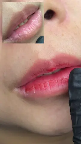 Bin ghiền xem những chiếc M.O.I sau B.O.N.G 24h #hutdungdich #khuthammoi #phunmoisoftlips #phunmoitunhien #phunmoidep 