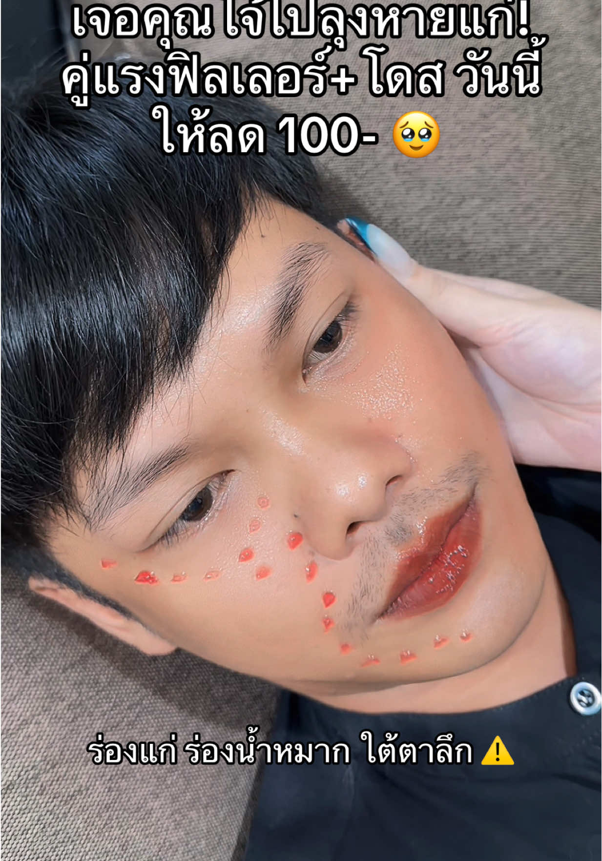 #โปรแรงแบบตะโกน #ครีมฟิลเลอร์ทาผิวหน้าตึง 