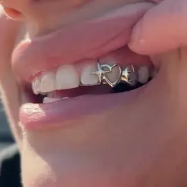 tiny heart braces big bright smiles💖✨🌟