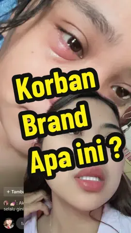 Udah langganan ternyata kenak PUBLIC WARNING BPOM si brand ini ya Allah kasian para korbannya 🥺 ini soal MATA jangan dipakai main main ya. Buat brand yg udh pernah masuk PUBLIC WARNING BPOM sama sama kita BOIKOT karena kayak percuma ngasih maaf ke mereka 🥺 kayak diulangin diulangin lagi @dr. Ika @Dokter Detektif New! @Verra | Brand Strategy 360 @Apt Sandry | IKE ISTRI @Direktorat Pengawasan Kosmetik @cegahtangkal.bpom #stopcreamabalabal #1jutaedukasi #publicwarningbpom #bahaya #cancelculture 