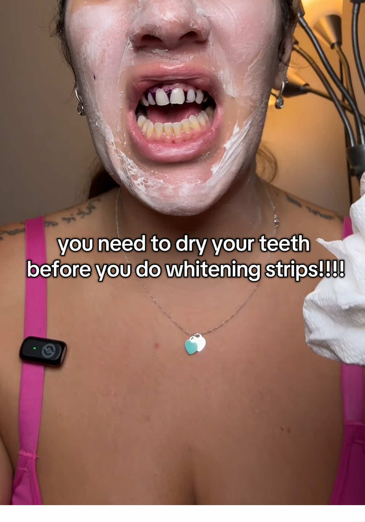 OMG BEST WHITENING STRIPS #toothwhitening #whiteningstrips #whiteteeth #tiktokshopcybermonday #tiktokshopblackfriday 