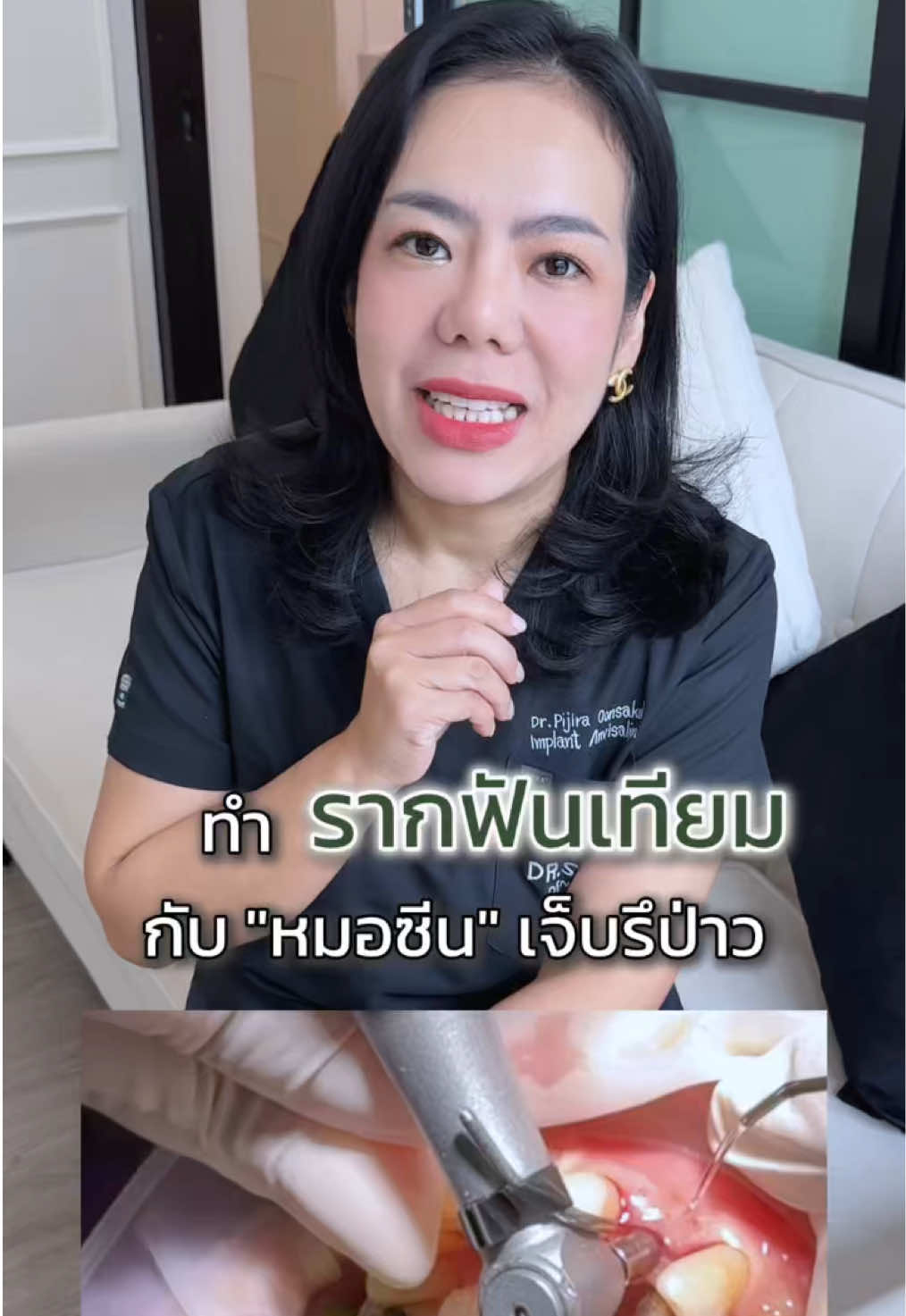 ทำรากฟันเทียมกับ หมอซีนเจ็บรึป่าว  ? #หมอซีนมือเบา #drseenclinic #tiktokkuni 