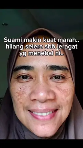 Akk berjeragat kulit kusam masuk live skrg #tiktoklive #fyp #foryoupage #serum #set 