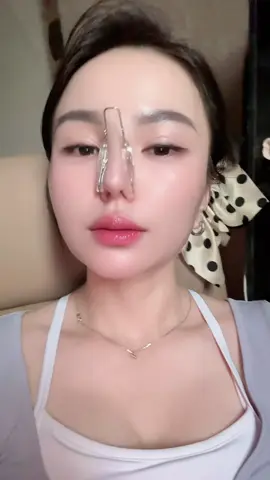 Mới đi nâng mũi về đây mấy bà #nangmui #lamdep #tiplamdep #muicao #hienxeo 