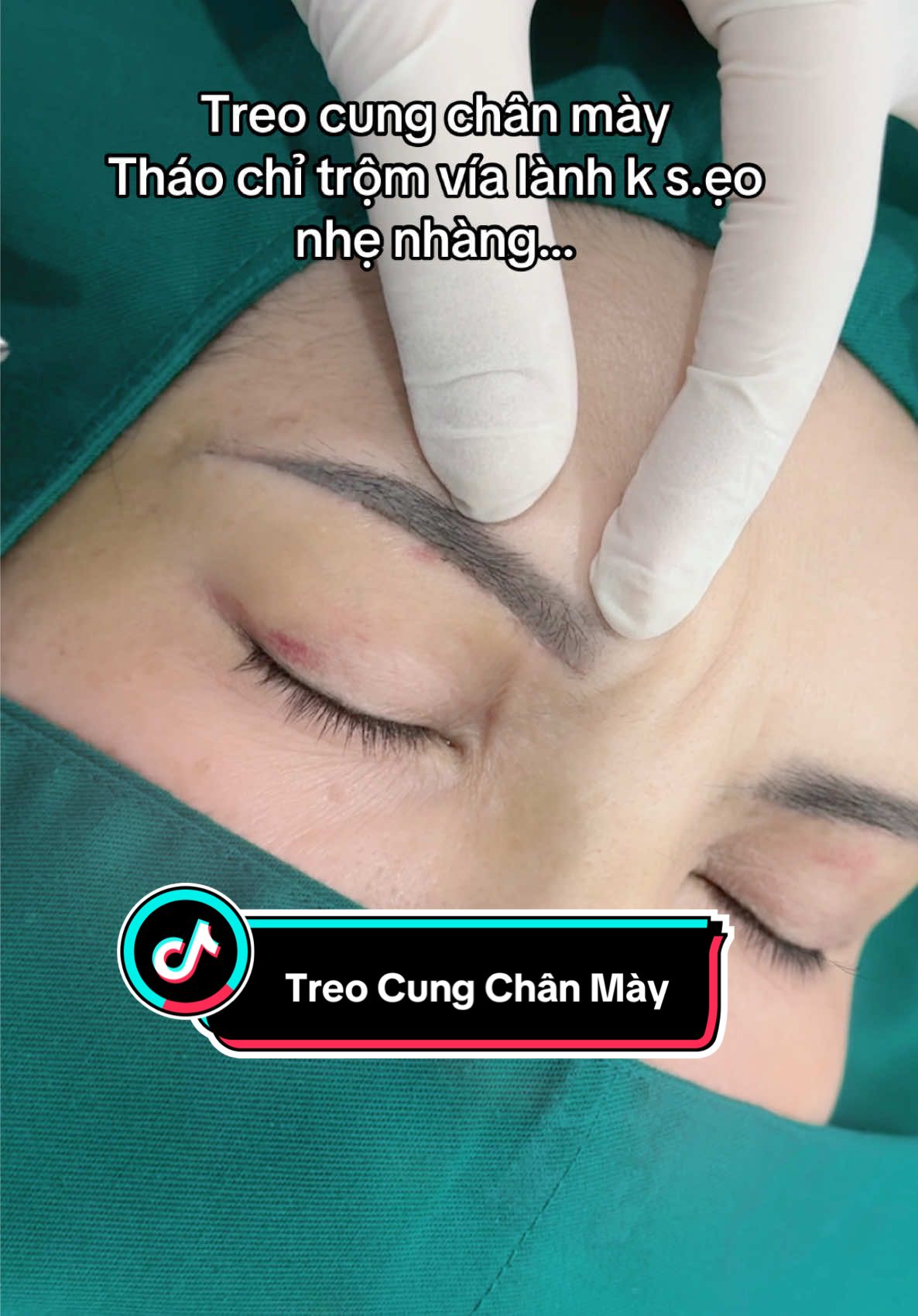 Mấy mẹ, cô ,dì chần chờ gì nữa Tết đến nơi rồi #treocungchanmay #cắtmíđẹp #nhấnmí #cắtmí #HoàiNhi 