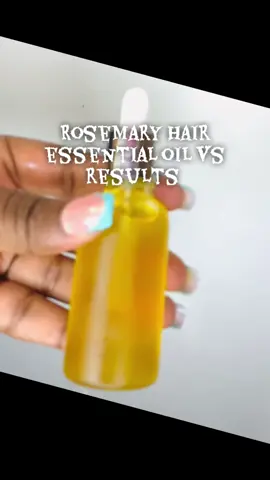 #creatorsearchinsights benefits: prevent hair loss, promote hair growth, improve scalp health, alleviate itchy scalp,