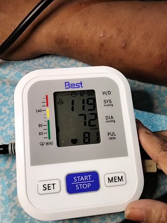 Replying to @alvinmorenoberedo Anytime ma monitor na ang blood pressure natin. #bloodpressuremonitor #bpmonitor #bloodpressurecheck #bloodpressure #highbloodpressure 