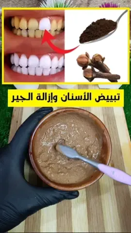 إزالة جير الأسنان وتبيضها #صحتي_بالعربي #وصفة #viral #صحتي #fyp 