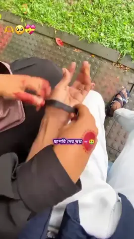 same same but different 🥱🥱😖😎😎🇪🇺🇮🇹🇮🇹#fyp #foryou #viralvideo #italy🇮🇹 #tiktokbangladesh🇧🇩 