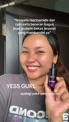 Pantesan aja… ternyata ini kunci bekas jerawat memudar! 🤫🫴🏻 #skincareroutine 