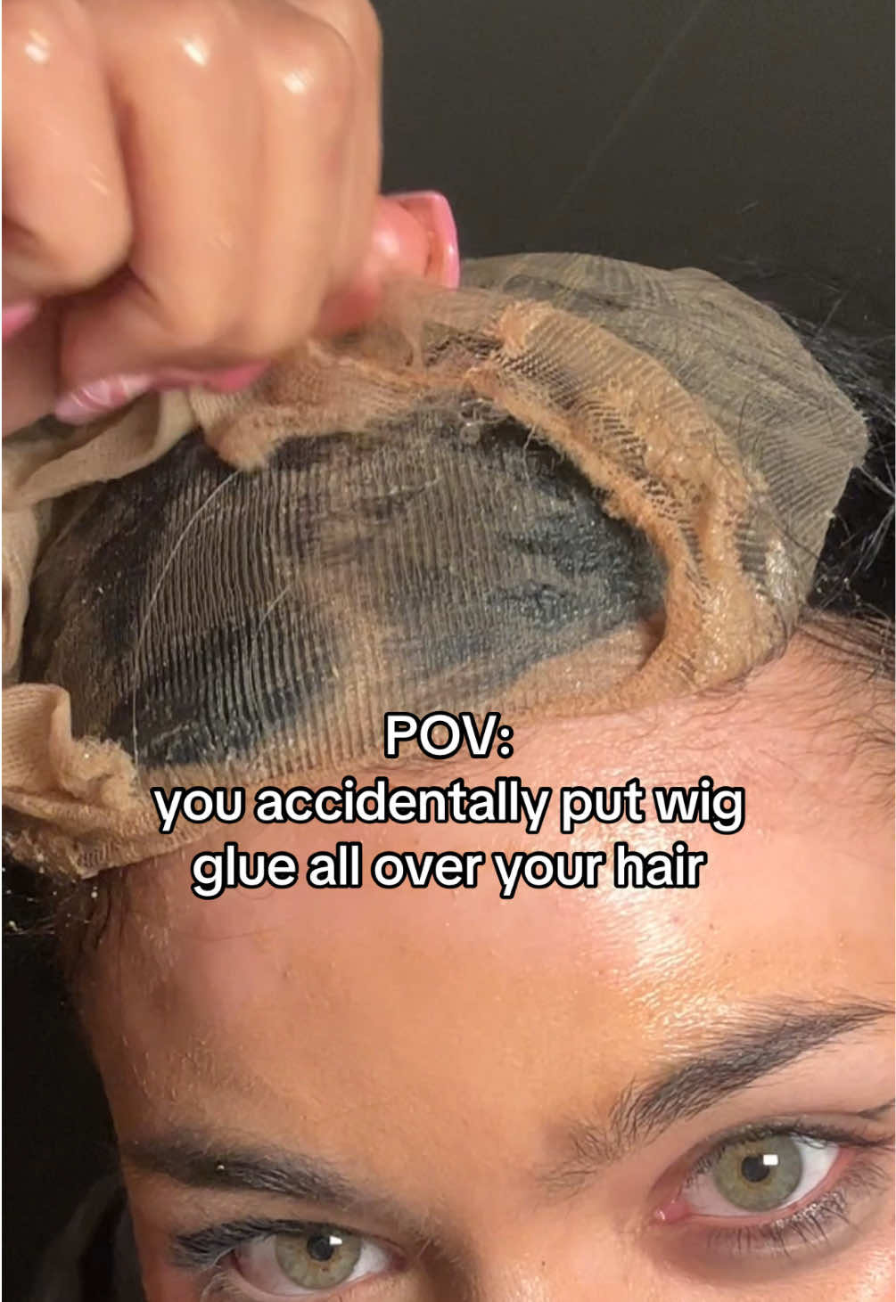 Warum dachte ich dass es auf die ganze #wigcap muss?!😭😭 Meinung?😘❤️#wig#wiginstall#fail#wigglue 