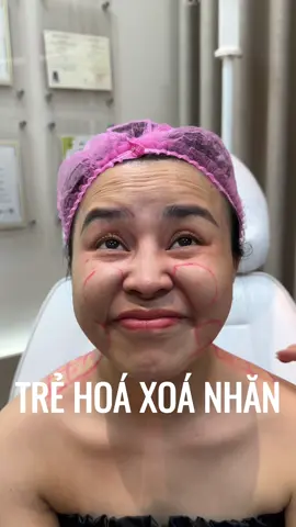 Trẻ hoá xoá nhăn hiệu quả không #TikTokAwardsVN #trendingtiktok #filler #viral #viralvideo 