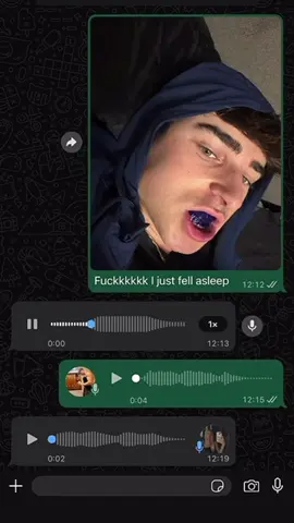 I’ve done it again… 🤦‍♂️😭#teeth #teethwhitening #oralhealth #drdent #whiteningstrips 