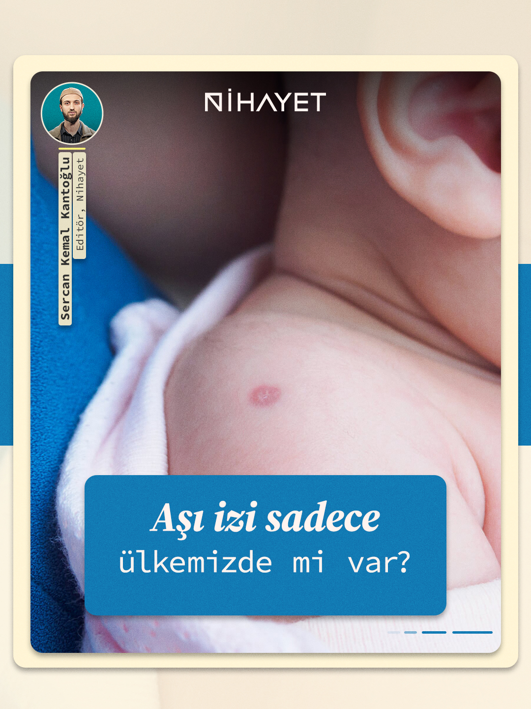 Aşı izi sadece ülkemizde mi var? 👀 Bu iz, aşının derinin en üst tabakasına uygulanmasından kaynaklanan ve vücudun başarılı bir bağışıklık tepkisi verdiğini gösteren normal bir sonuçtur.