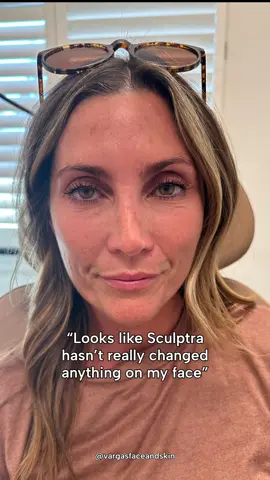 The long game is REAL 💉✨ Sculptra builds your own collagen for natural, lasting results — and it’s on sale now during our Bi-Annual Filler Event! 👏 📍 Dr. Hannah Vargas | Facial Plastic Surgeon | Prairie Village, KS 📞 913.381.4900 | Complimentary consultations available #sculptra #injectables #collagen #naturalresults #skin