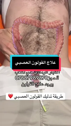 #علاج_طبيعي #حجامة #الرمادي #الشعب_الصيني_ماله_حل😂😂🙋🏻‍♂️ #تصميم_فيديوهات🎶🎤🎬 