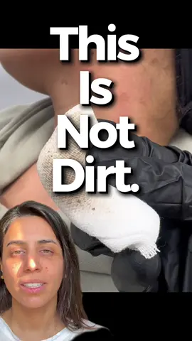 It’s not dirt. It’s derm😉 #terrafirmeforme #dirtyneck #skincare #skineducation 