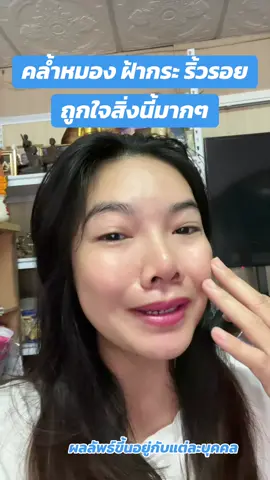 จากใจคนเป็นกระ ผิวแห้ง อยากบูสผิวแบบดูแลครบ ลองดูน๊า!! #ijeewp #ฝ้ากระ #ผิวแห้ง #มอยเจอร์ไรเซอร์ #mondaymoist 