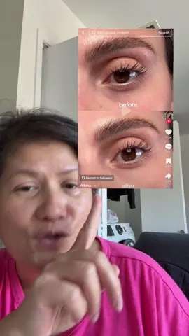 I am so impressed by her result #axisyeyeserum #axisycollageneyeserum  #eyeserum #collageneyeserum #darkcirclesundereyes 