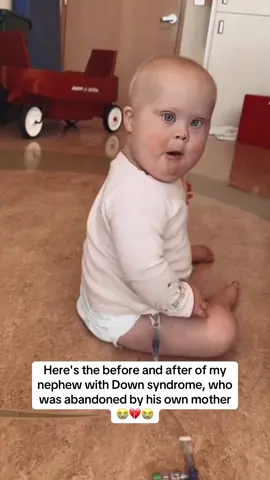 How did she have the courage 😭💔😭 #downsyndrome #son #daughter #baby #sister 