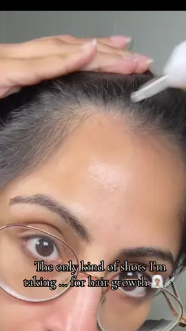 PDRN shots to the rescue @VT Cosmetics US #pdrn #hairgrowth #reedleshot #haircare #blackfriday 