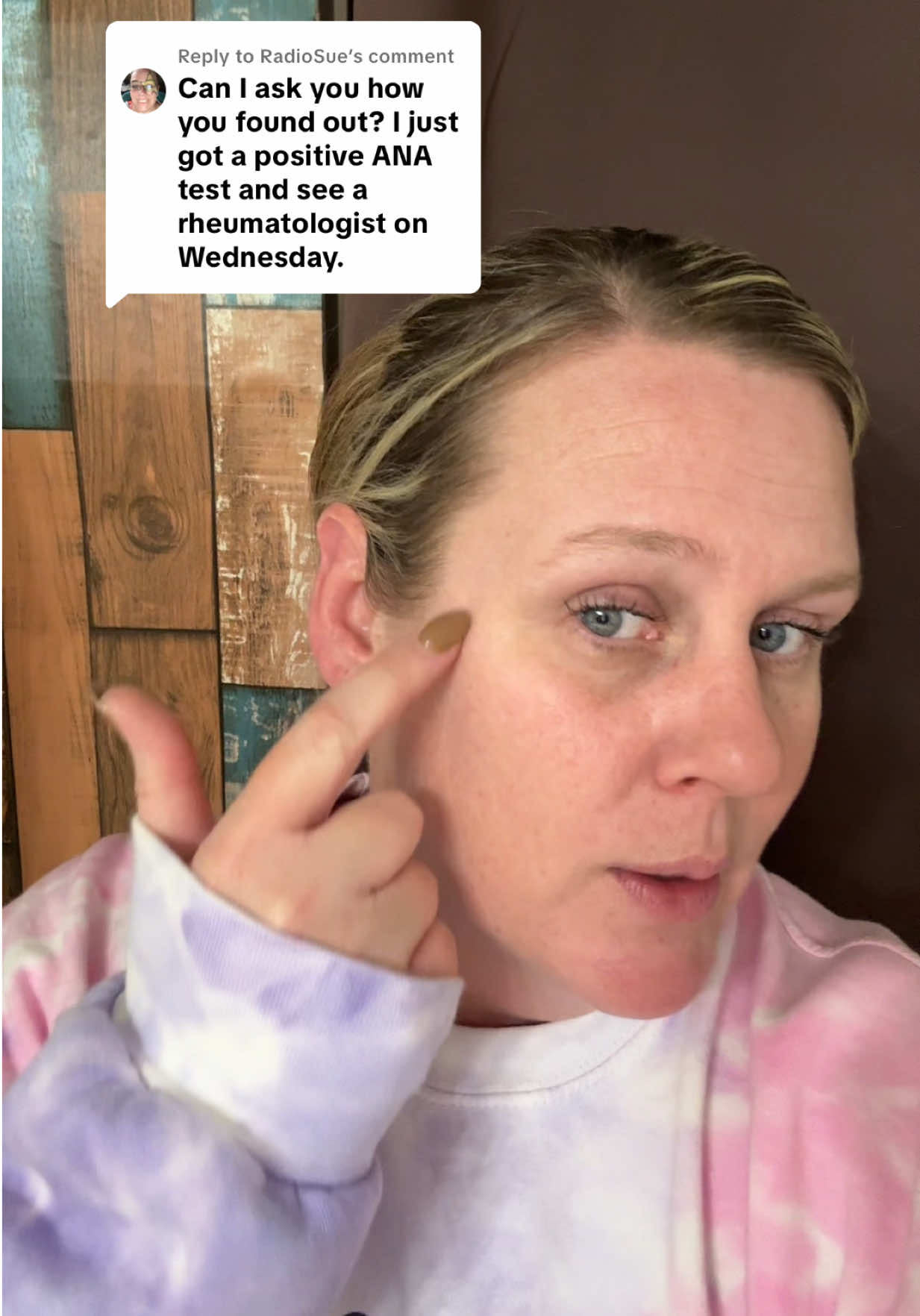 Replying to @RadioSue how I was diagnosed with lupus! #lupusawareness #lupusdiagnosis #lupus it’s a daily struggle 